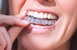 Alinhadores invisíveis: conforto e estética no tratamento ortodôntico moderno